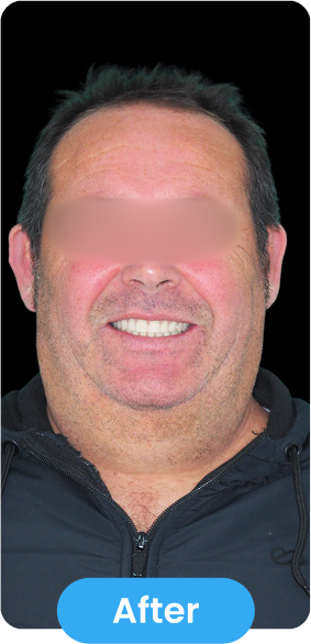 After Image